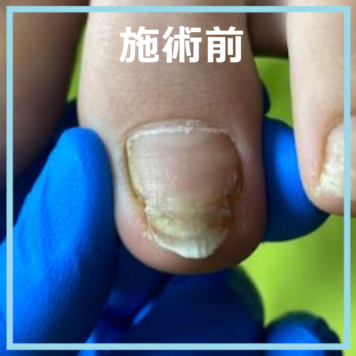 施術前
